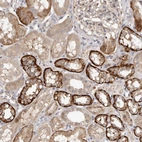 Immunohistochemical staining of human kidney shows moderate to strong cytoplasmic positivity in cells in tubules.