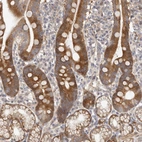 Immunohistochemical staining of human duodenum shows strong cytoplasmic positivity in glandular cells.