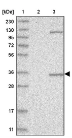 Lane 1: Marker [kDa] 230, 130, 95, 72, 56, 36, 28, 17, 11_br/_Lane 2: Human cell line RT-4_br/_Lane 3: Human cell line U-251MG sp