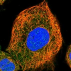 Immunofluorescent staining of human cell line A-431 shows localization to cytosol & microtubules.