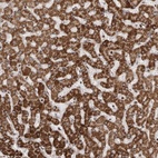 Anti-AZIN1 Antibody