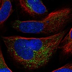 Immunofluorescent staining of human cell line U-2 OS shows localization to vesicles.