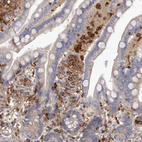 Anti-CBL Antibody