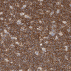 Immunohistochemical staining of human tonsil shows strong membranous positivity in germinal center cells.