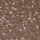 Immunohistochemical staining of human tonsil shows strong membranous positivity in germinal center cells.