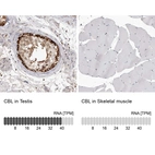 Immunohistochemistry analysis in human testis and skeletal muscle tissues using HPA027956 antibody. Corresponding CBL RNA-seq data are presented for the same tissues.