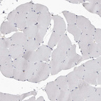 Immunohistochemical staining of human skeletal muscle shows no positivity in myocytes as expected.