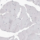 Immunohistochemical staining of human skeletal muscle shows no positivity in myocytes as expected.