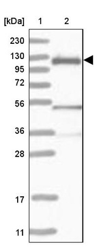 Lane 1: Marker [kDa] 230, 130, 95, 72, 56, 36, 28, 17, 11_br/_Lane 2: Human cell line RT-4