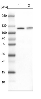 Lane 1: NIH-3T3 cell lysate (Mouse embryonic fibroblast cells)_br/_Lane 2: NBT-II cell lysate (Rat Wistar bladder tumour cells)