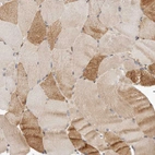 Anti-PANK4 Antibody