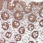 Immunohistochemical staining of human colon shows moderate cytoplasmic positivity in glandular cells.