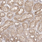 Immunohistochemical staining of human kidney shows moderate cytoplasmic positivity in cells in tubules.