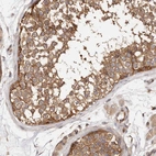 Immunohistochemical staining of human testis shows strong cytoplasmic positivity in cells in seminiferous ducts.