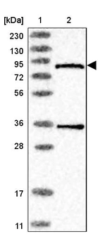 Lane 1: Marker [kDa] 230, 130, 95, 72, 56, 36, 28, 17, 11_br/_Lane 2: Human cell line RT-4