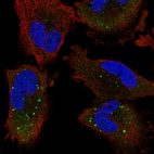 Immunofluorescent staining of human cell line U-251 MG shows localization to cytosol & cytoplasmic bodies.