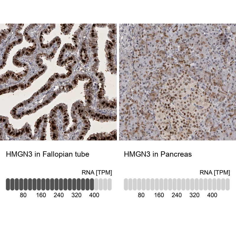 Anti-HMGN3 Antibody