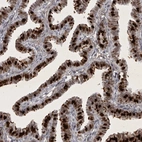 Immunohistochemical staining of human fallopian tube shows high expression.