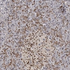 Immunohistochemical staining of human pancreas shows low expression as expected.