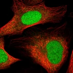 Immunofluorescent staining of human cell line U-2 OS shows localization to nucleoplasm.