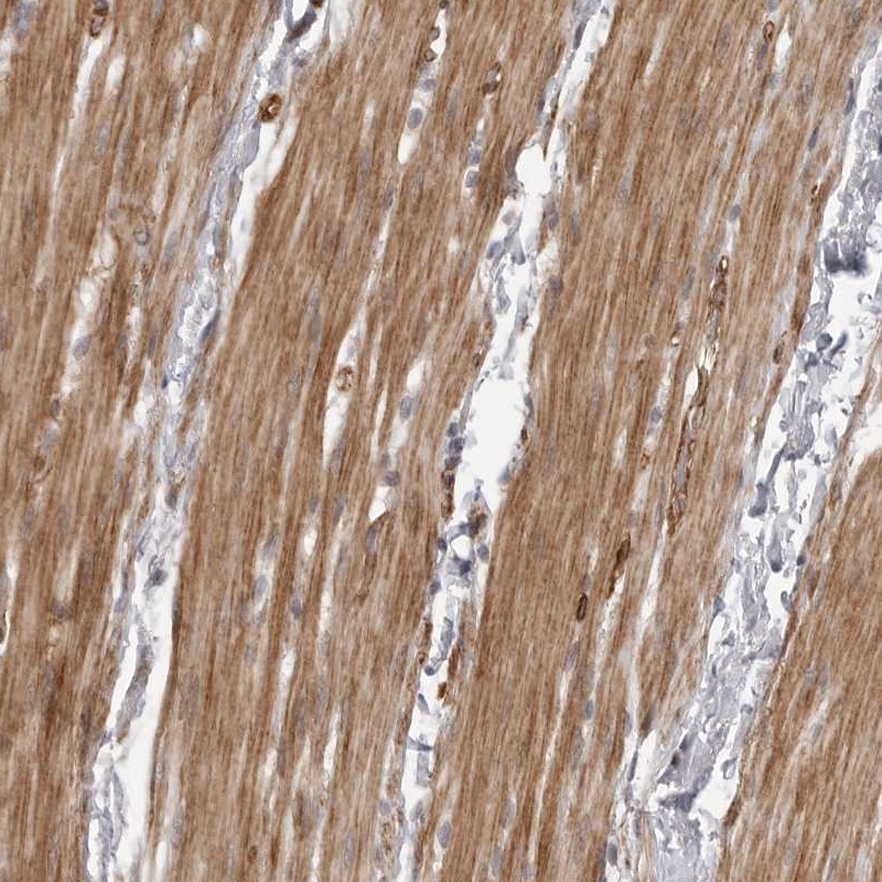 Anti-ZCCHC11 Antibody