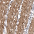 Anti-ZCCHC11 Antibody