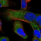 Immunofluorescent staining of human cell line U-251 MG shows localization to cytosol.