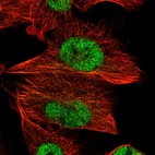 Immunofluorescent staining of human cell line U-251 MG shows localization to nucleoplasm & microtubules.