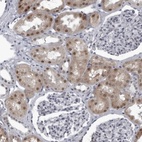 Anti-RTCA Antibody