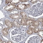 Anti-RTCA Antibody