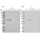 Western blot analysis using Anti-RTCA antibody HPA027982 (A) shows similar pattern to independent antibody HPA027990 (B).