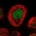 Immunofluorescent staining of human cell line A-431 shows localization to nucleus.