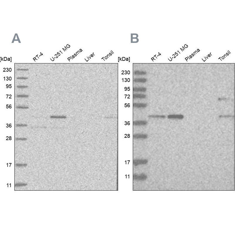 Anti-RTCA Antibody