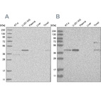 Anti-RTCA Antibody