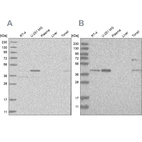 Anti-RTCA Antibody