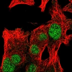 Immunofluorescent staining of human cell line Hep G2 shows localization to nucleoplasm.