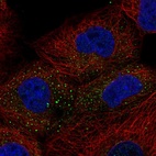 Immunofluorescent staining of human cell line A-431 shows localization to vesicles.