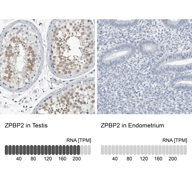 Anti-ZPBP2 Antibody