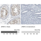 Anti-ZPBP2 Antibody