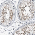 Immunohistochemical staining of human testis shows high expression.