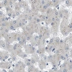 Immunohistochemical staining of human liver using Anti-ZPBP2 antibody HPA027997.