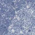 Immunohistochemical staining of human lymph node using Anti-ZPBP2 antibody HPA027997.