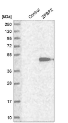 Western blot analysis in control (vector only transfected HEK293T lysate) and ZPBP2 over-expression lysate (Co-expressed with a C-terminal myc-DDK tag (~3.1 kDa) in mammalian HEK293T cells, LY403691).