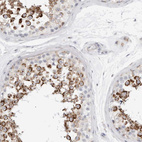 Anti-ATPIF1 Antibody