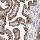 Immunohistochemical staining of human fallopian tube shows strong cytoplasmic granular positivity in glandular cells.