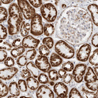 Immunohistochemical staining of human kidney shows strong cytoplasmic granular positivity in cells in tubules.