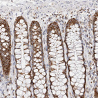 Immunohistochemical staining of human rectum shows strong cytoplasmic granular positivity in glandular cells.