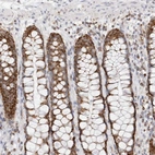 Immunohistochemical staining of human rectum shows strong cytoplasmic granular positivity in glandular cells.