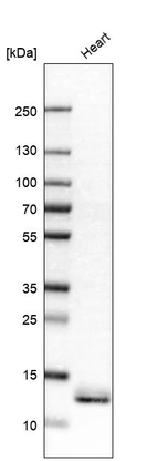 Western blot analysis in human heart tissue.