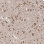 Anti-GSK3B Antibody